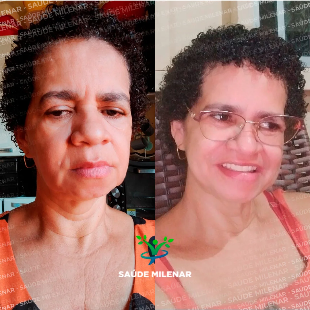 Antes e depois_11