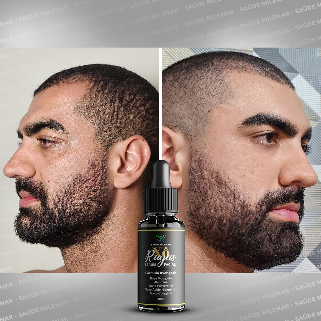 eu(Marca) Sérum - 0202