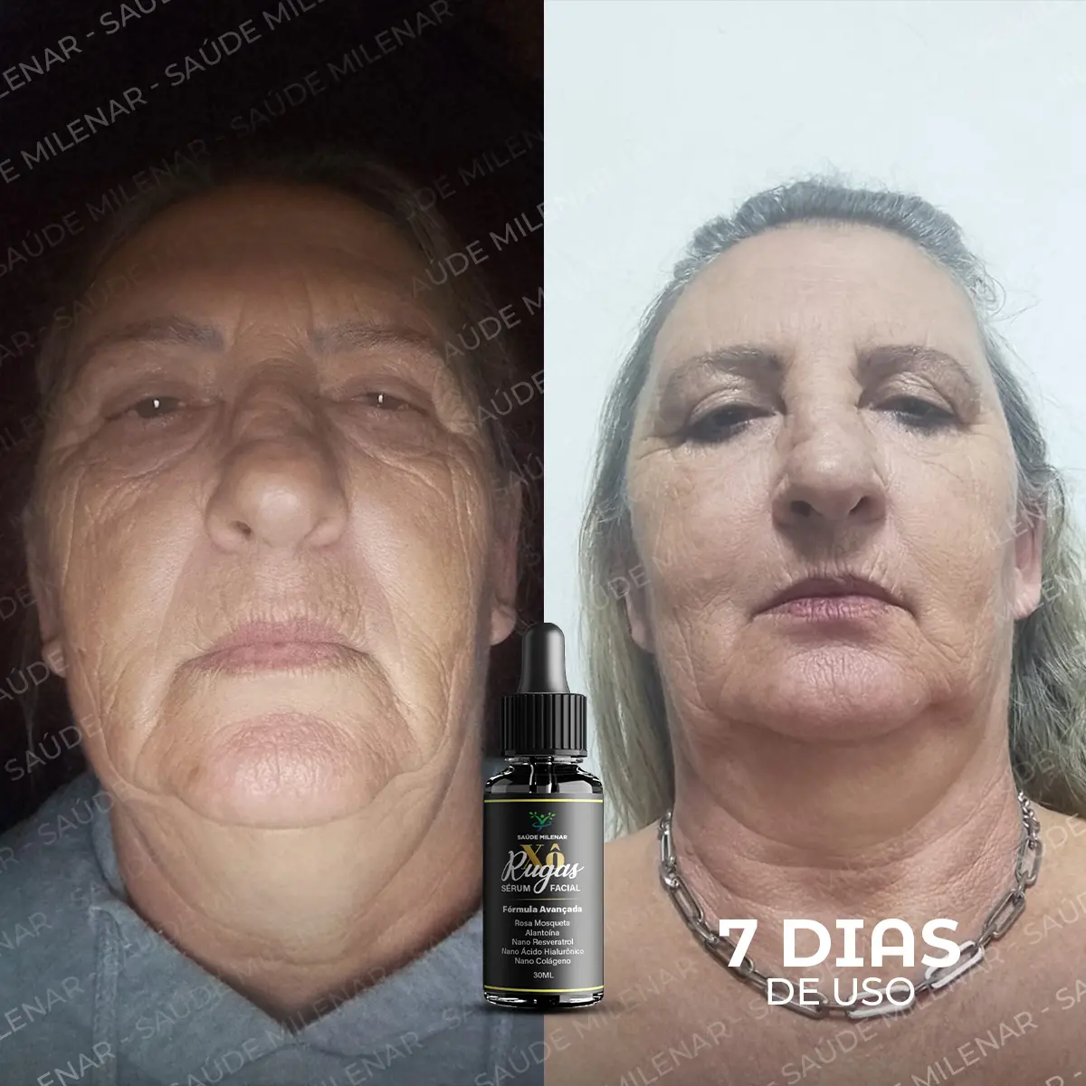 Antes e Depois (7 dias) serum