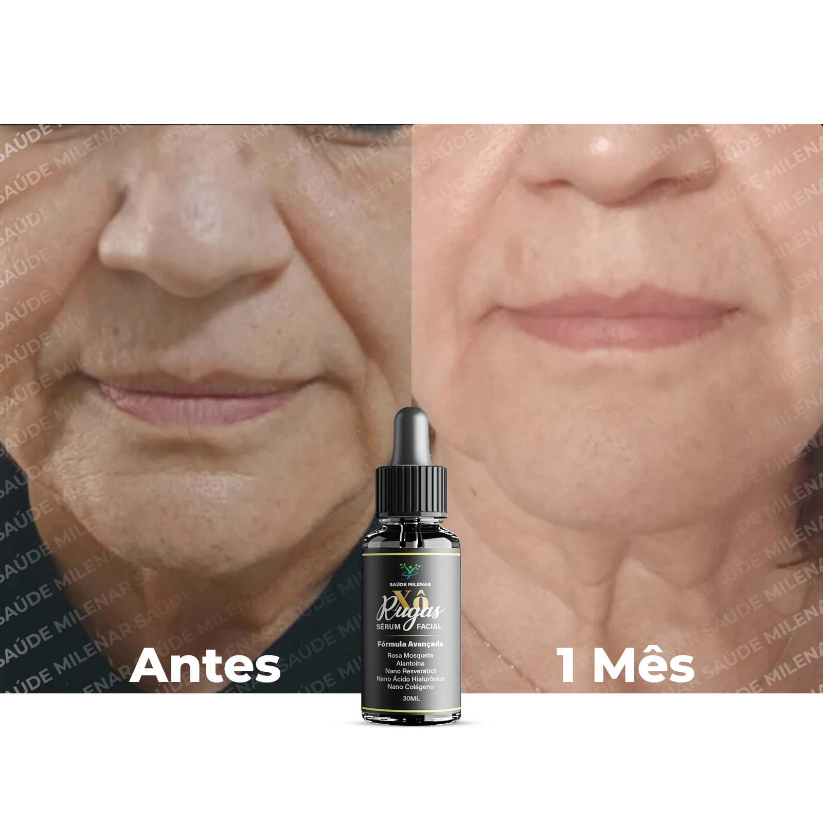 ANTES E DEPOIS_01 Serum