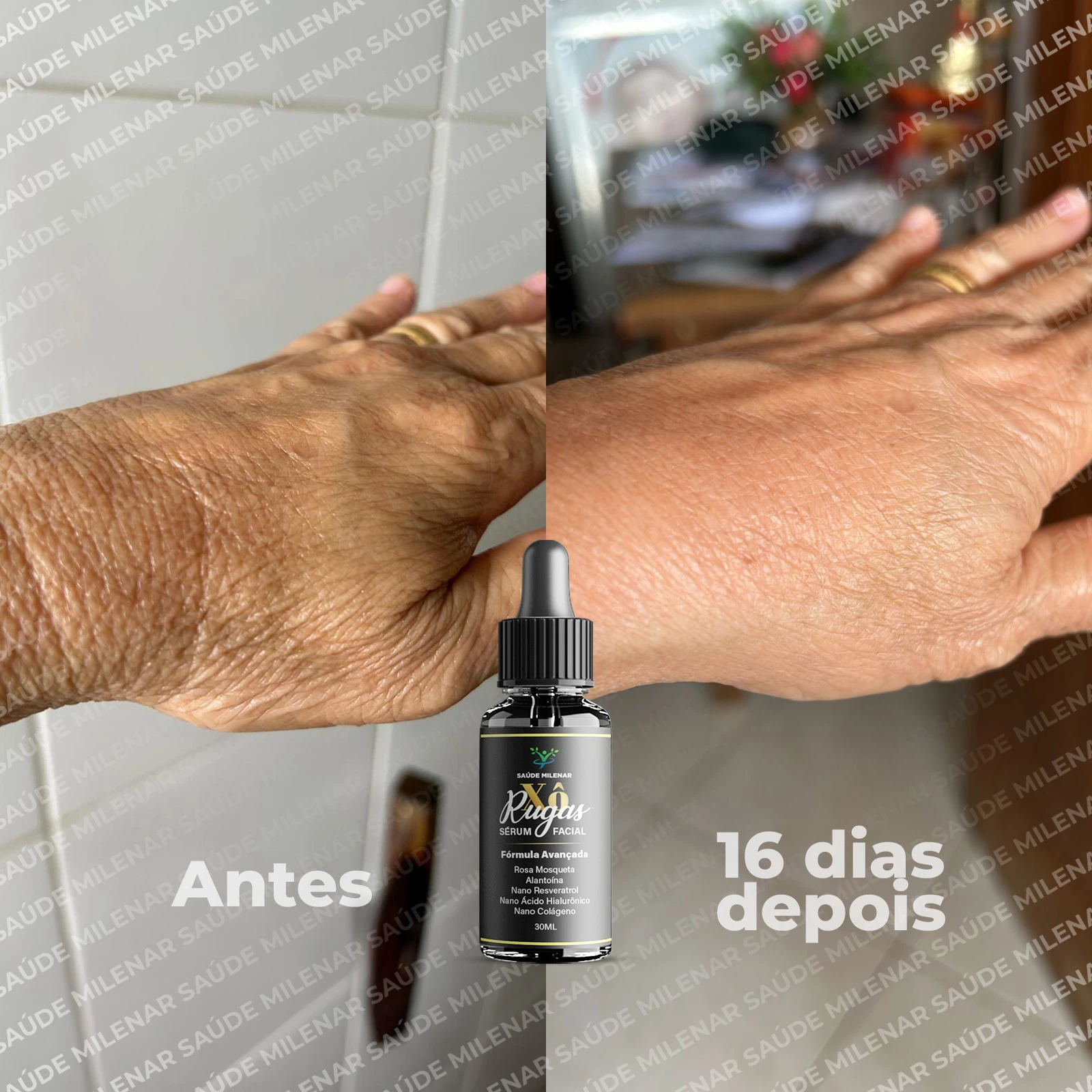 ANTES E DEPOIS_02 (Serum)