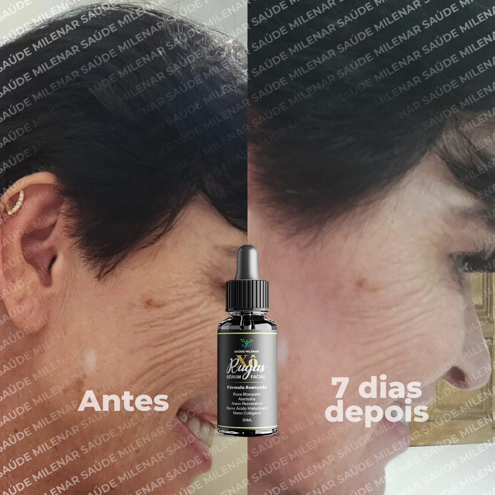 ANTES E DEPOIS_03 (Serum)